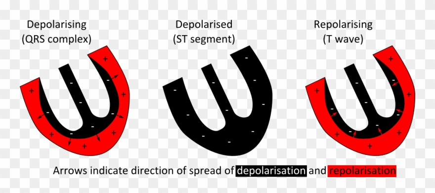 Royalty Free Stock Natalies Casebook Tag Figure The - T Wave Upward Deflection Clipart