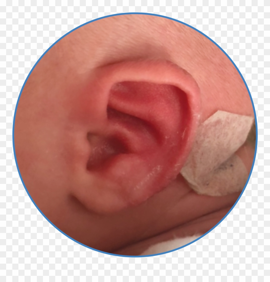 Earbuddies Reviews Results Parents Ear Of The Month - Icc Clipart