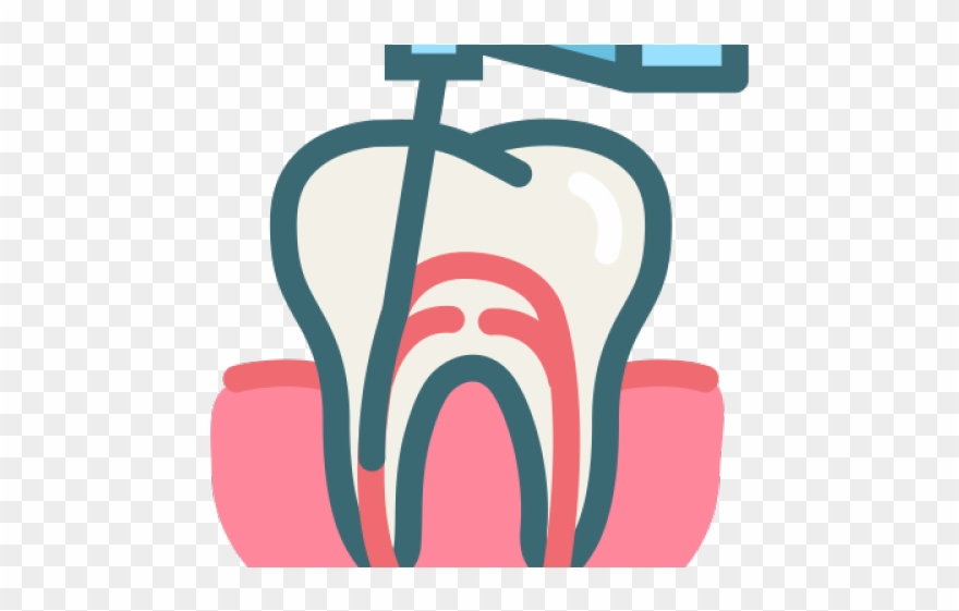 Teeth Clipart Root Canal - Root Canal Treatment Icon - Png Download