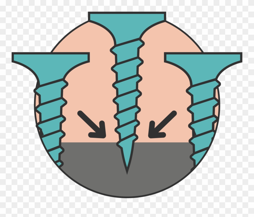 Does R Guard Self Seal Around Fasteners Clipart