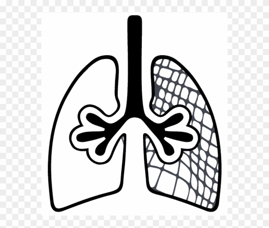 Chronic Obstructive Pulmonary Disease - Scireq Scientific Respiratory Equipment Inc Clipart