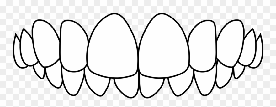 Overbite Clipart