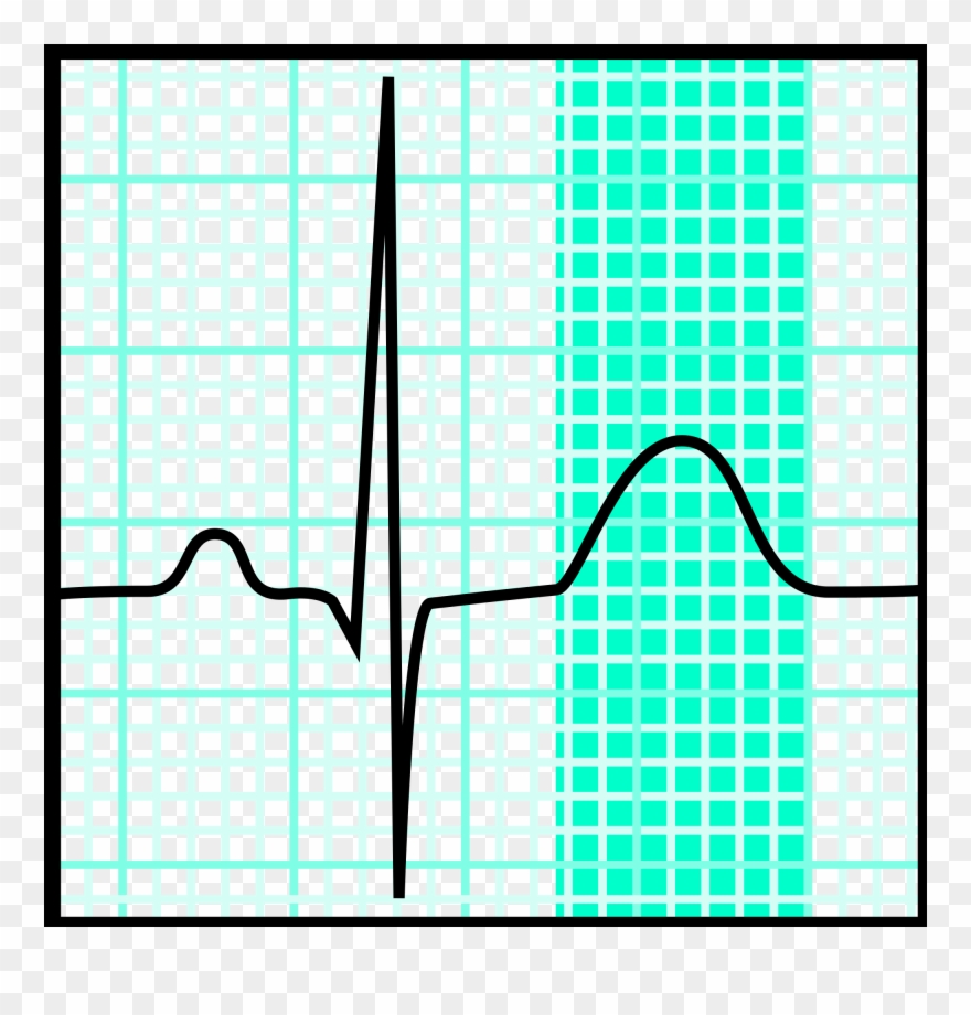 Rn Ecg Svg - Normal T Wave In Ecg Clipart