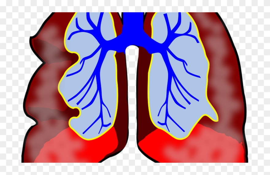 Fighting Fungous Respiratory Organ Infections With - Lungs Clip Art - Png Download