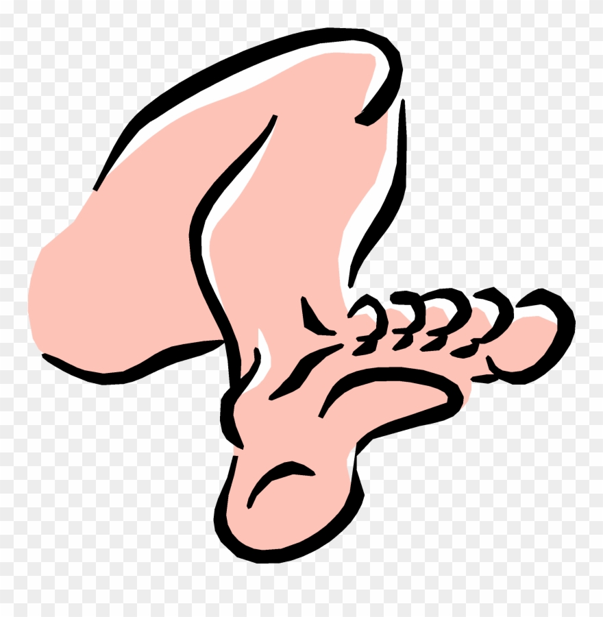 Significance Is That Pain May Be Due To Venous Insufficiency - Leg Clipart