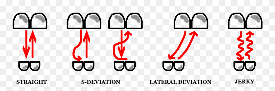 An Image Shows Five Sets Of The Two Front Teeth On Clipart