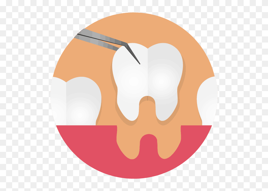 Three Teeth With One Being Extracted Graphic - Illustration Clipart