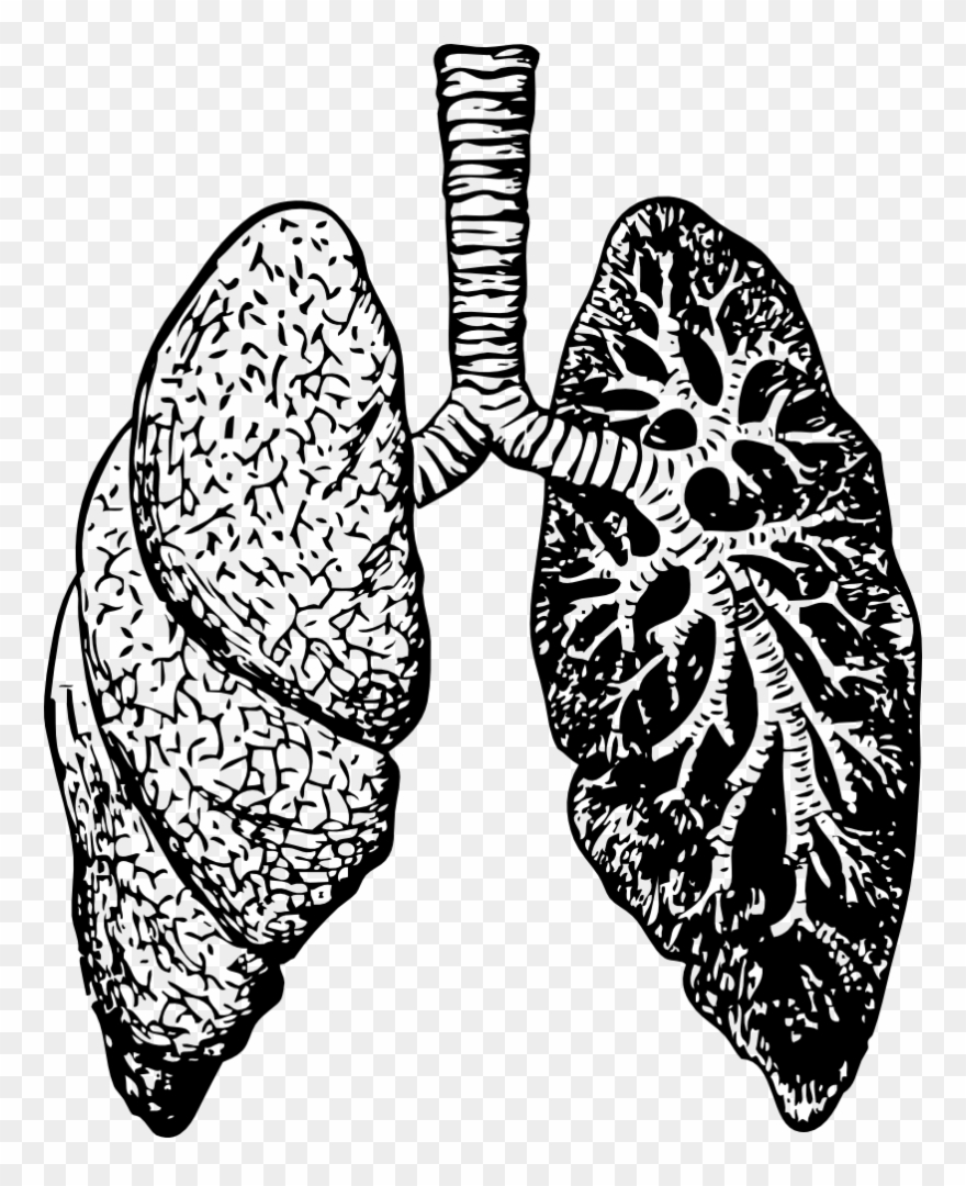 Medium Image - Dealing With Bronchitis: Overcoming Bronchitis And Clipart