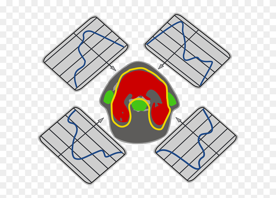 Sausage, Brain, Medicine, Lab, Magnet, Medical, Test - Imrt Clipart