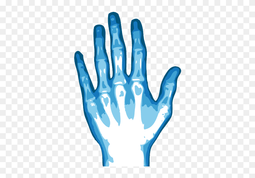 Download Free Png X - X Ray Png Transparent Clipart