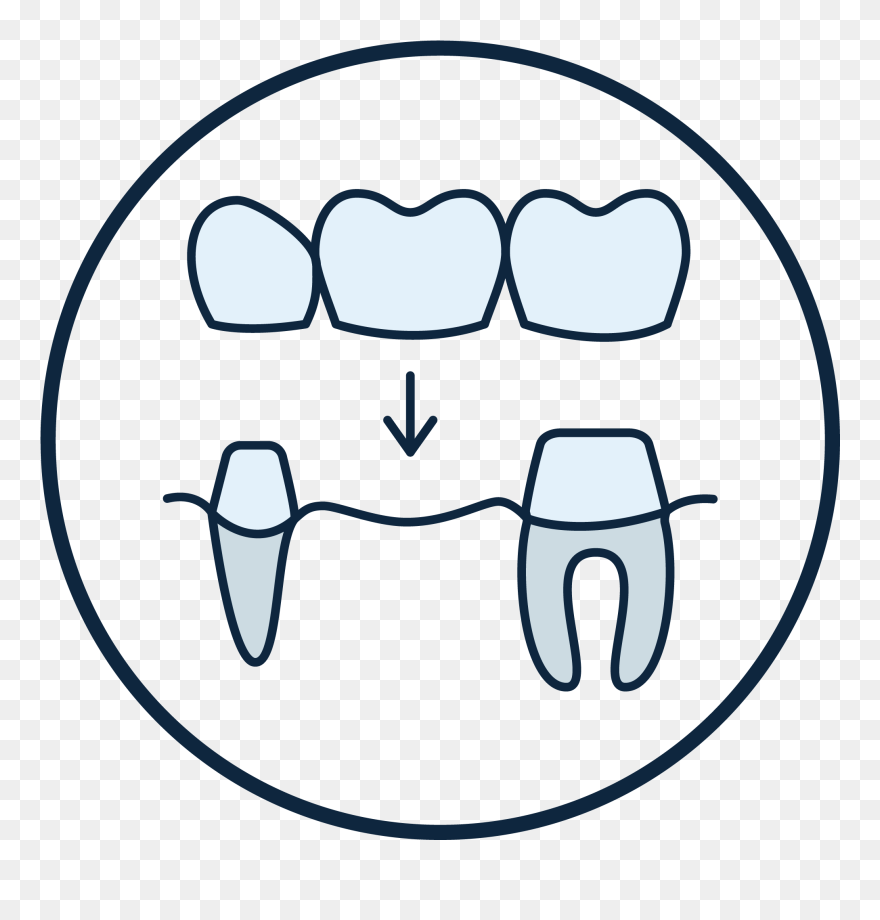 Icon For Dental Bridge Clipart