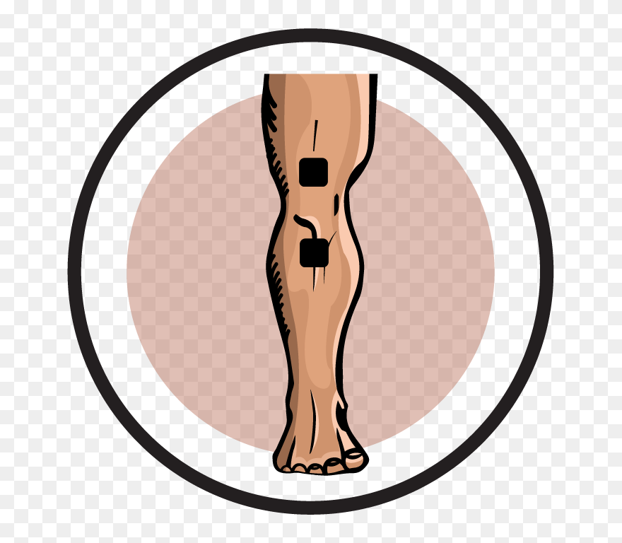 Ireliev Electrode Pad Placement - Illustration Clipart