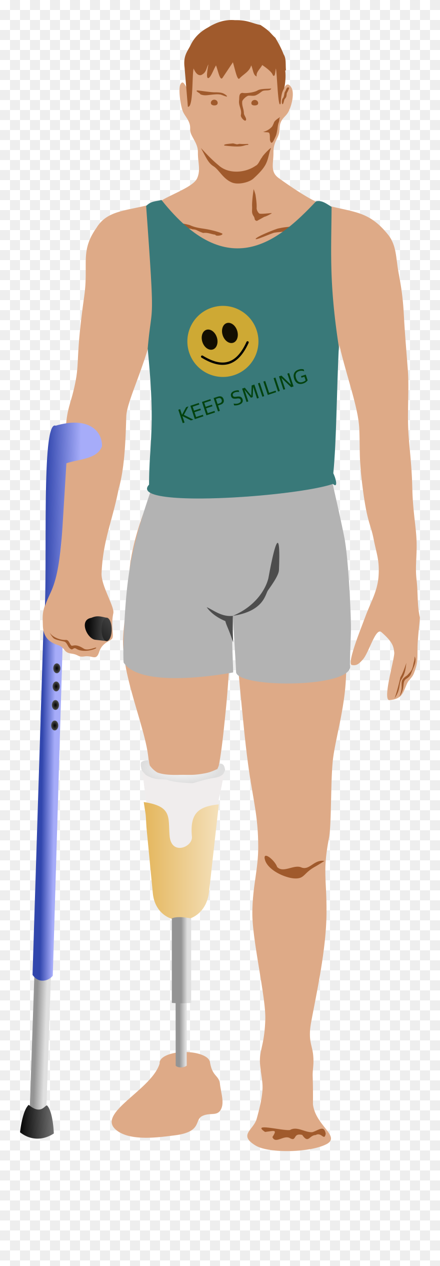 Man After Amputation Clipart By Moini - Amputation Clipart - Png Download