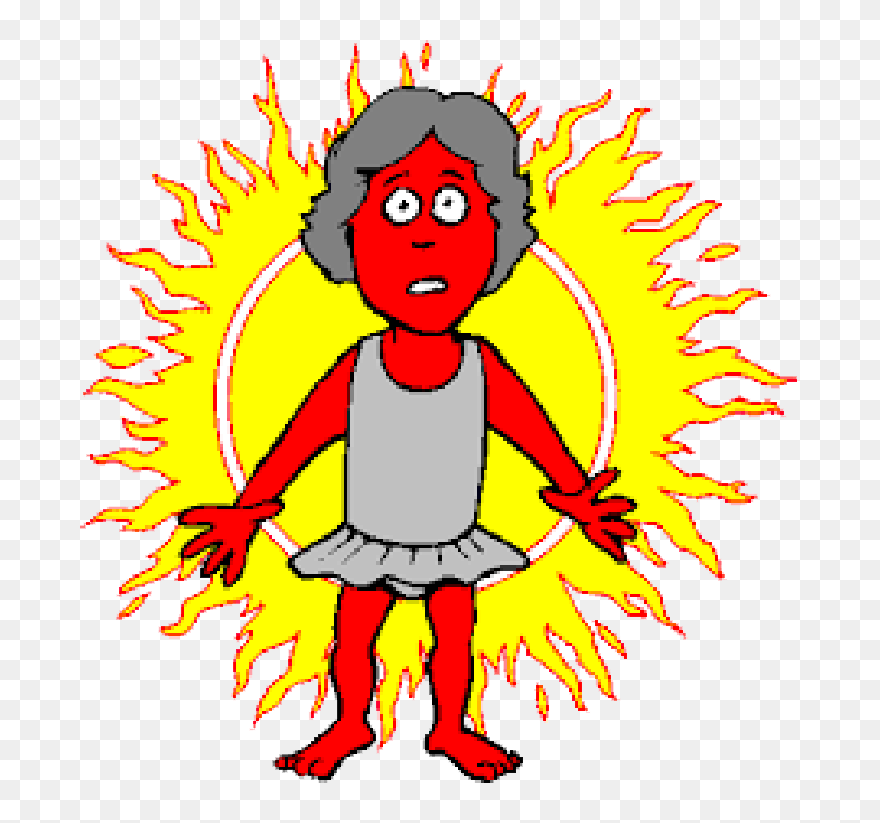 Sunburn Clipart - Png Download