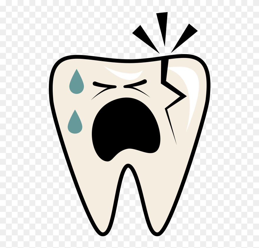 Cracked-tooth - Cracked Tooth Png Clipart