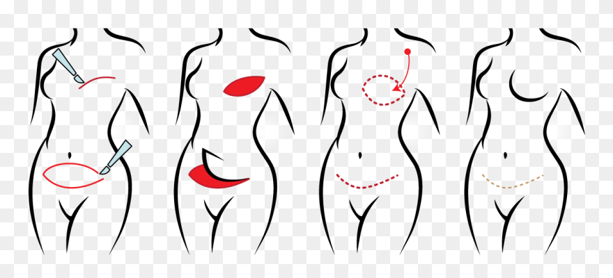 Diep Process Clipart