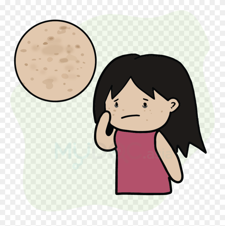 Juliet Station Pigmentation - Smiley Face Clipart