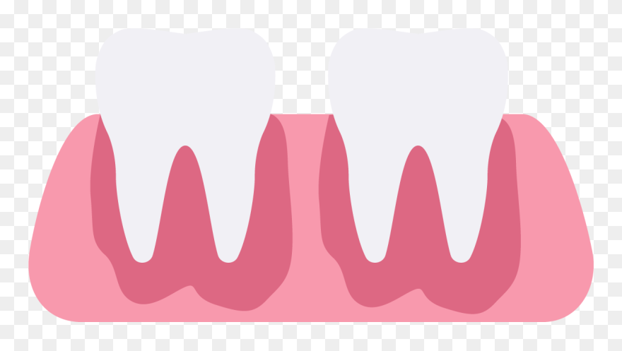 Gum Clipart Gum Disease - Gum Disease Clipart Transparent - Png Download