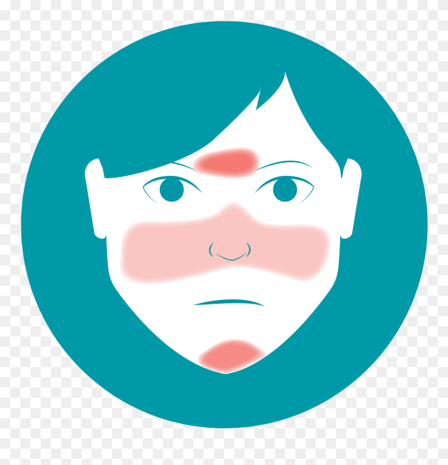 Show And Tell Clipart Skin Problem - Ville De Saint Etienne - Png Download