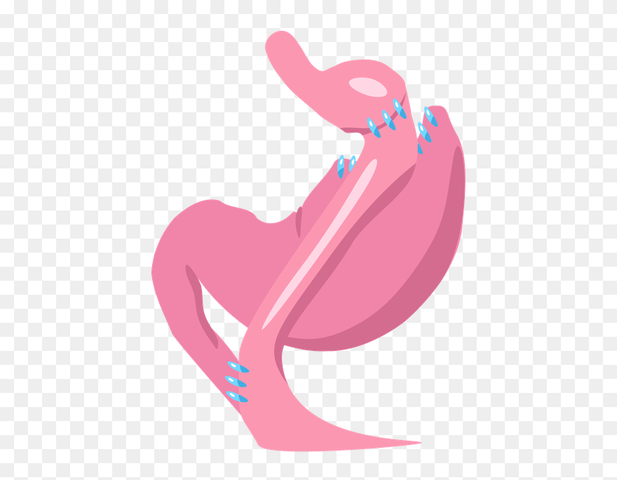 What Are The Tips - Gastric Bypass Clipart
