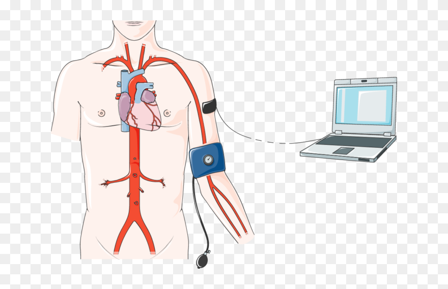Cardiac Catheterization Clipart