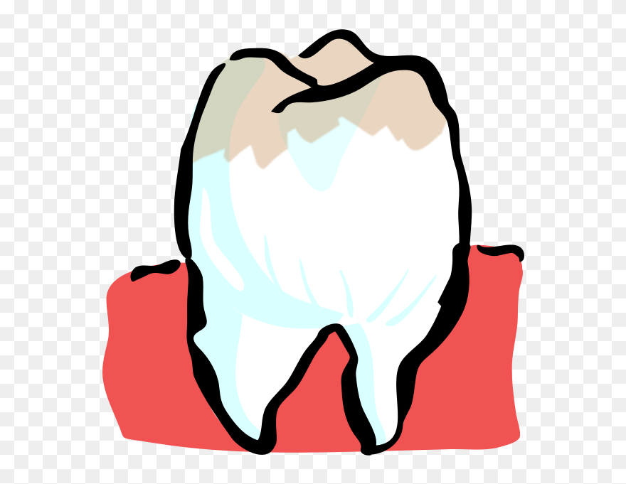 Architetto Dente - Teeth Clipart - Png Download