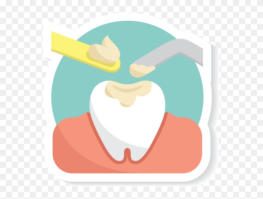 Dental Fillings - Illustration Clipart