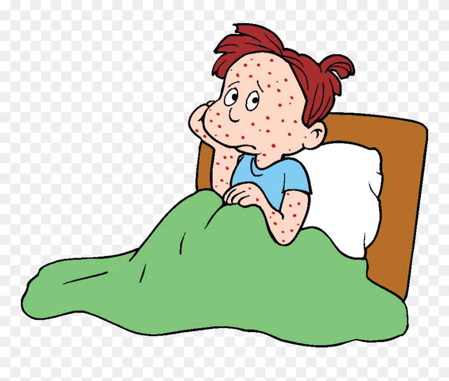 How To Deal With - Chicken Pox Clipart - Png Download