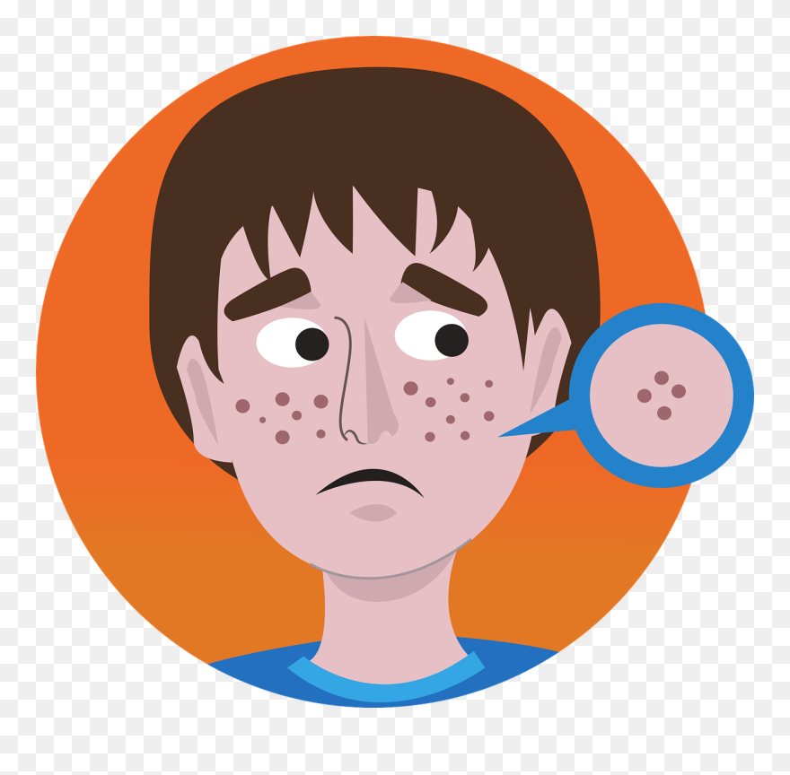 Acne Graphic Clipart