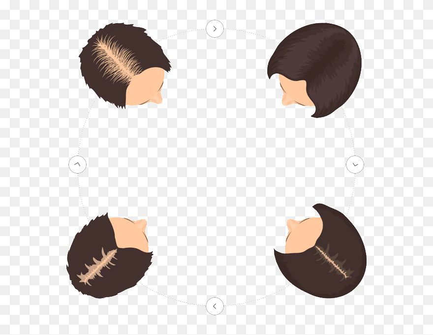 Women Hair Loss Stage Clipart