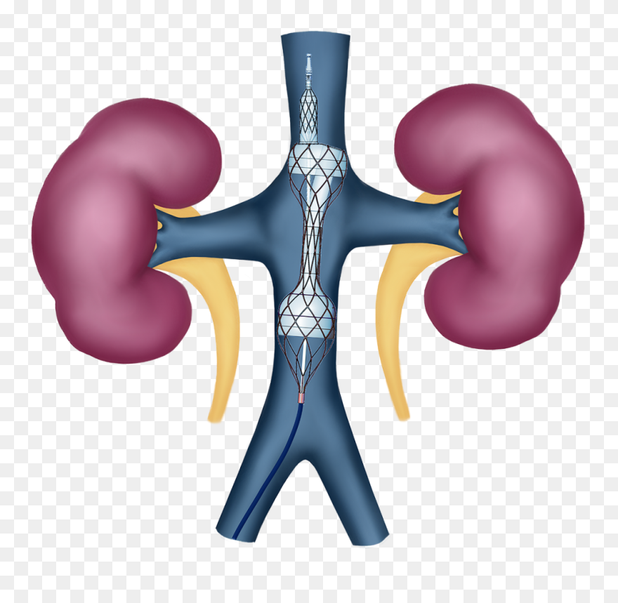 Illustration Clipart