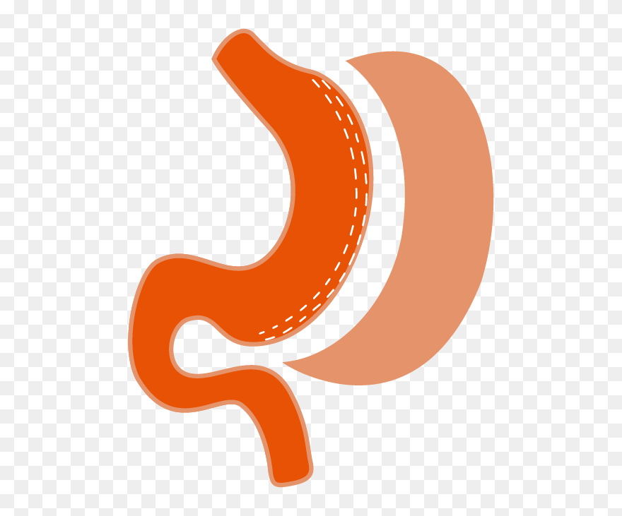 Laparoscopic Sleeve Gastrectomy Logo Clipart