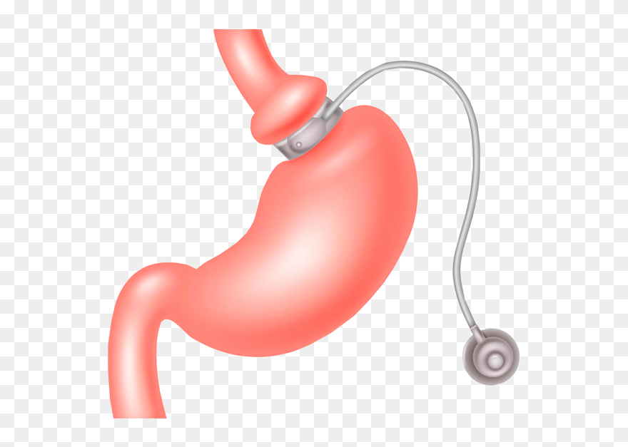 Adjustable Gastric Band Clipart