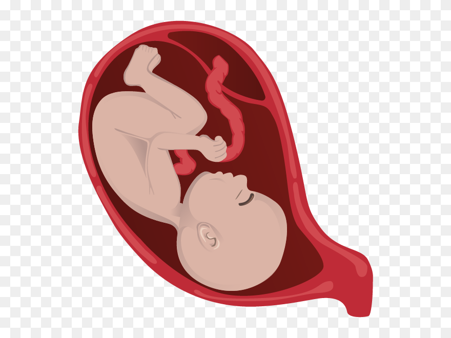 Spina Bifida Png Clipart