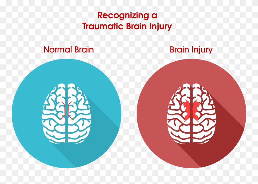 Tell If You Have Brain Damage Clipart
