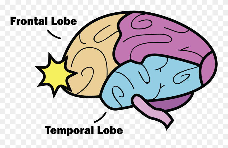 Clipart Brain Concussion - Frontal And Temporal Lobes Concussion - Png Download