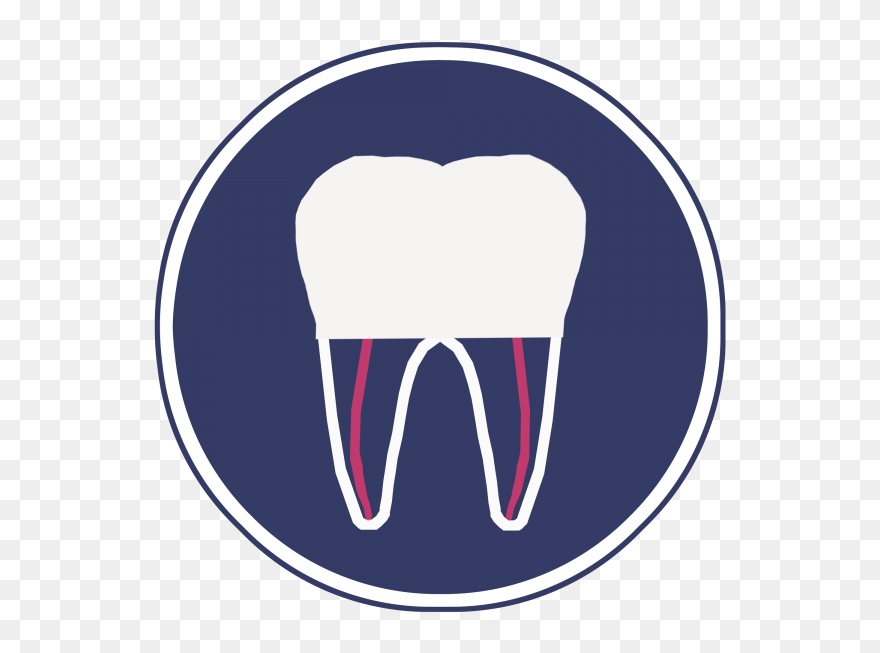 Root Canal Treatment Clipart