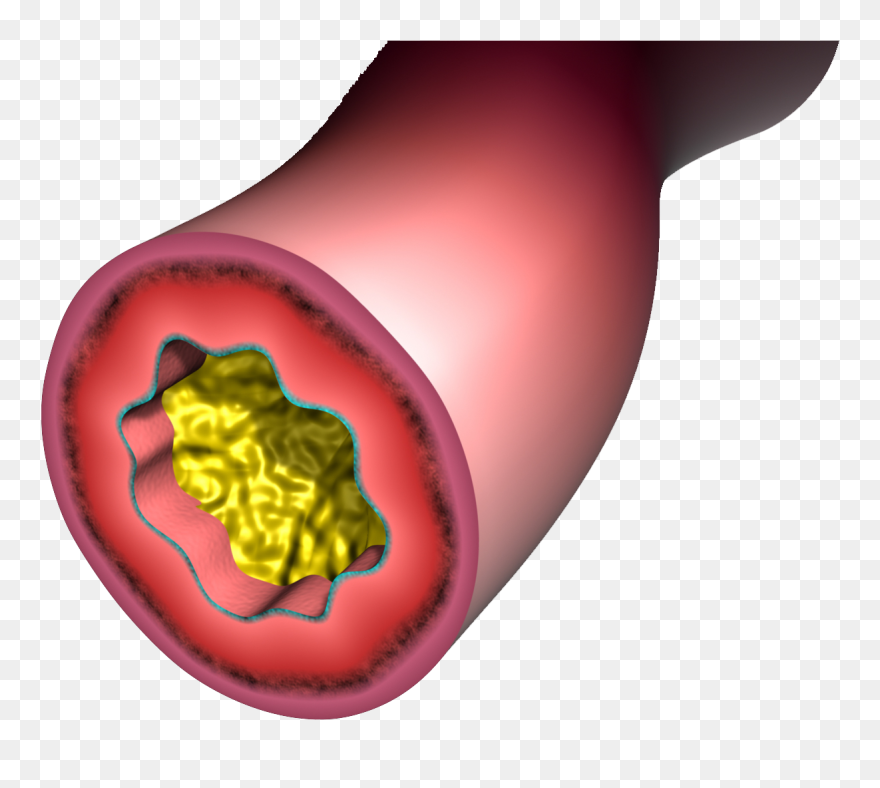 Illustration Clipart