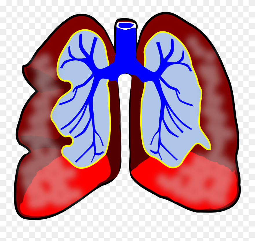 What Is Bronchitis Omaha Urgent Care - Lungs Clip Art - Png Download