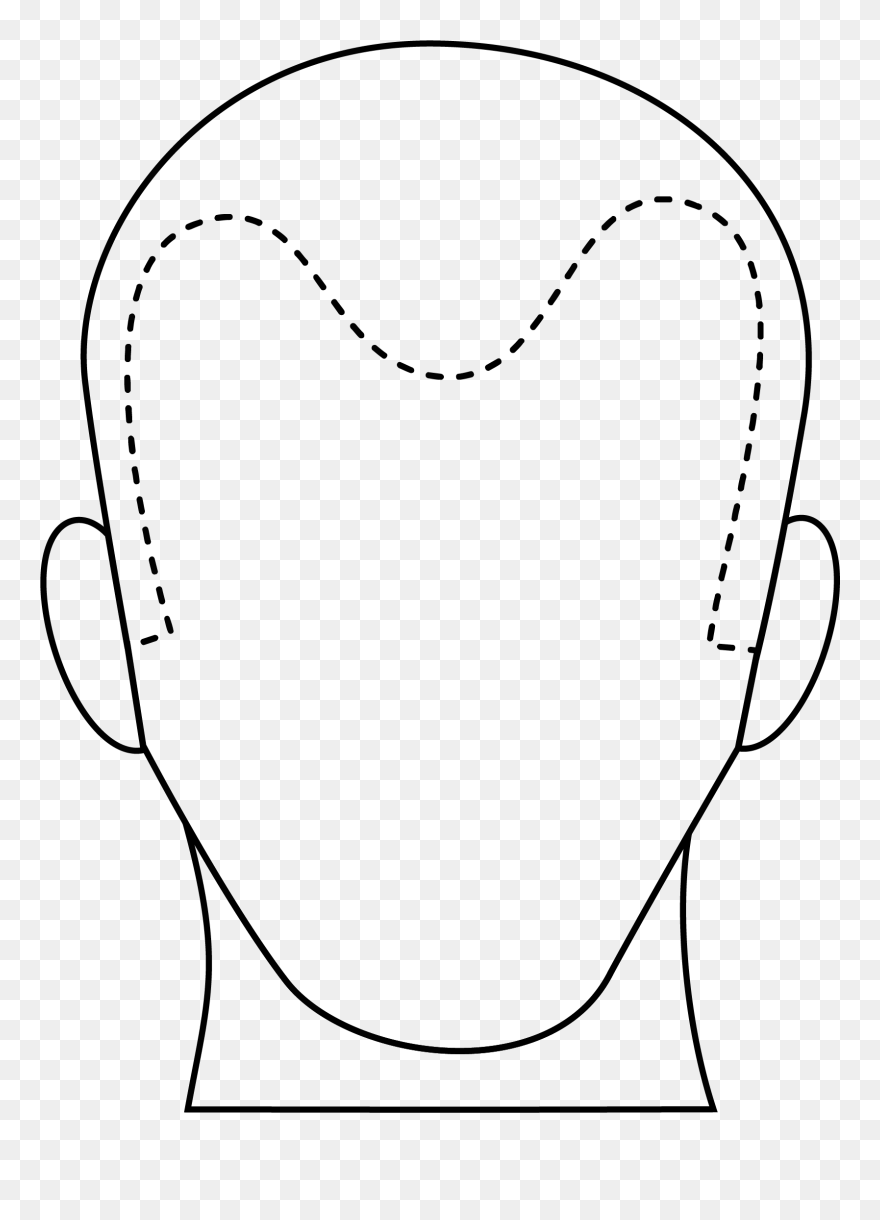 Male Hair Loss Line Art - Line Art Clipart
