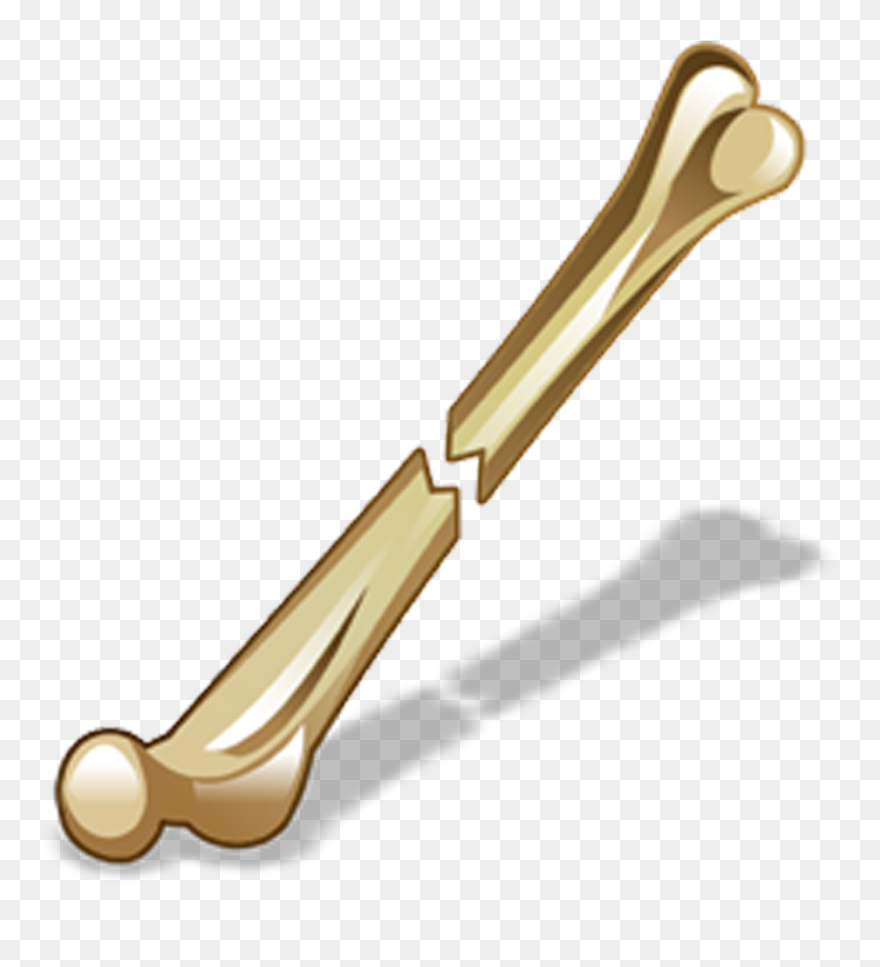 Bone Fracture Icon - Fracture Bone Png Clipart