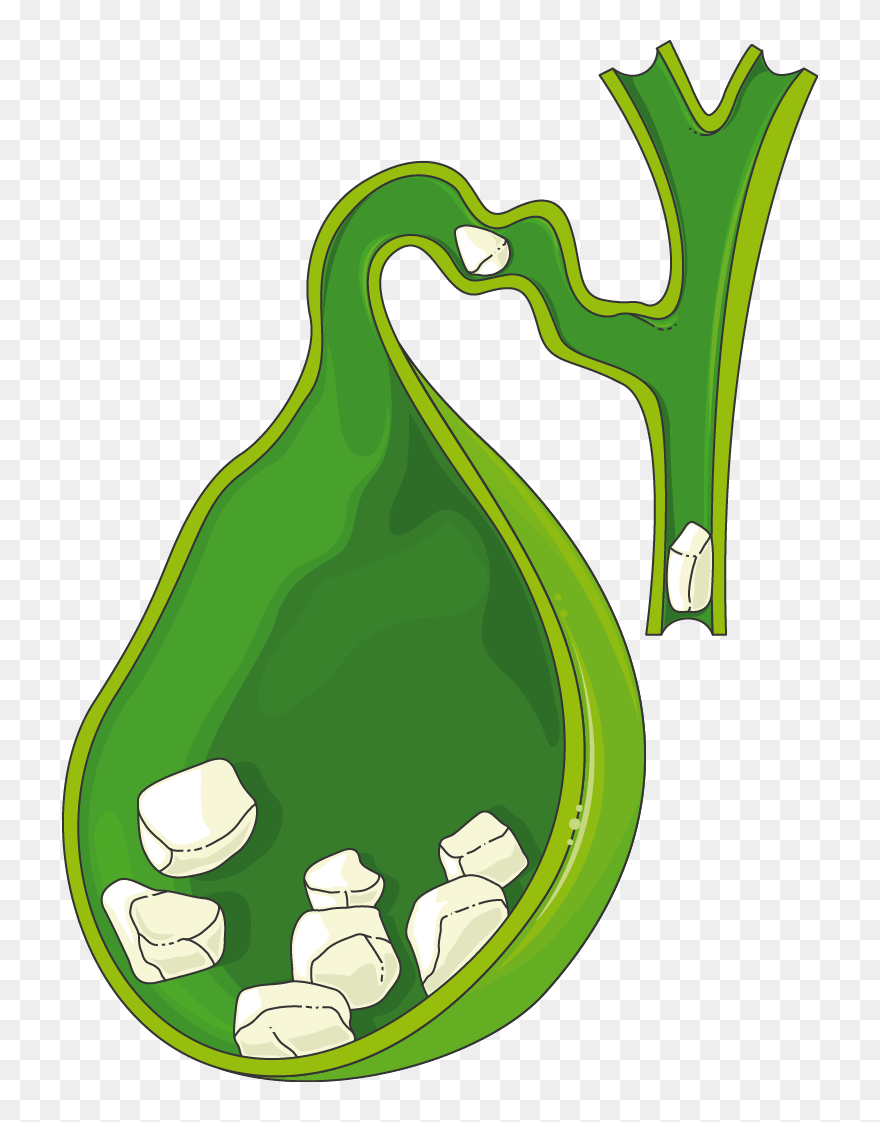 Gallbladder Clipart - Png Download