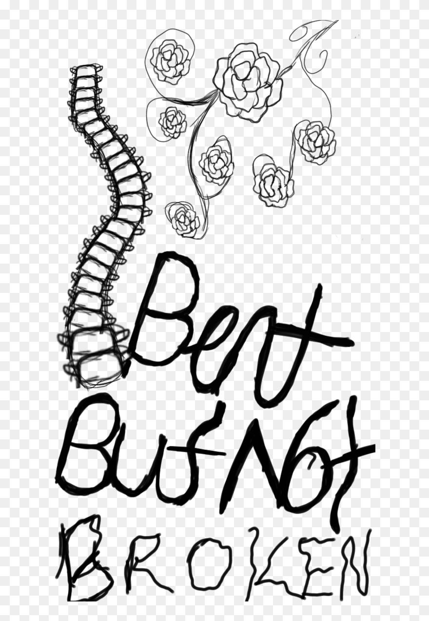 Collection Of Free Spine Drawing Scoliosis Download - Bent But Not Broken Scoliosis Clipart