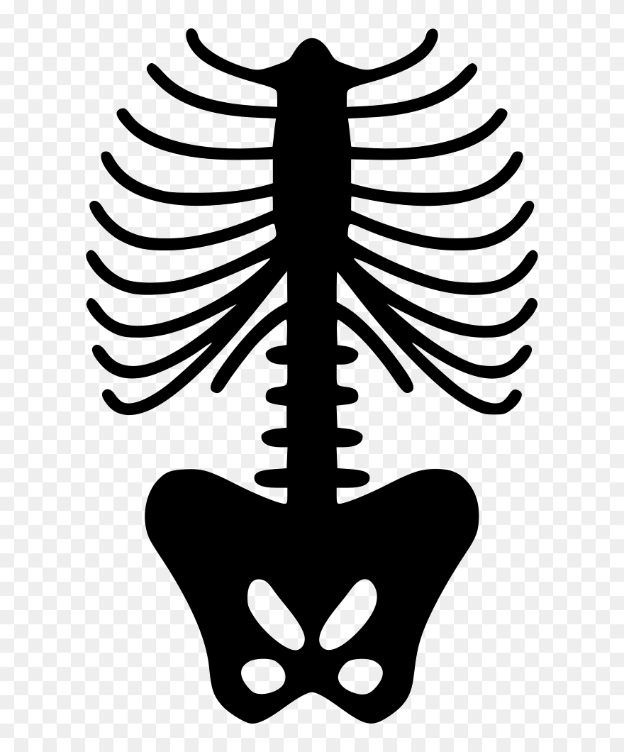 Spine Skeleton - Skeleton Rib Cage Pattern Clipart