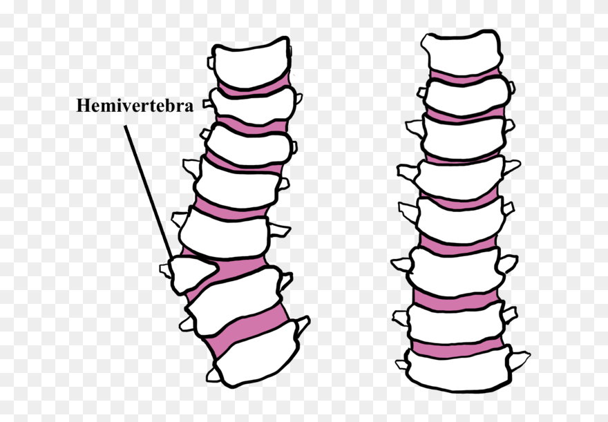 French Bulldog Spine Problems Clipart