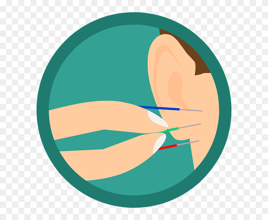 Ear-acupuncture - Pozitif Ağızdan Ağıza Pazarlama Clipart