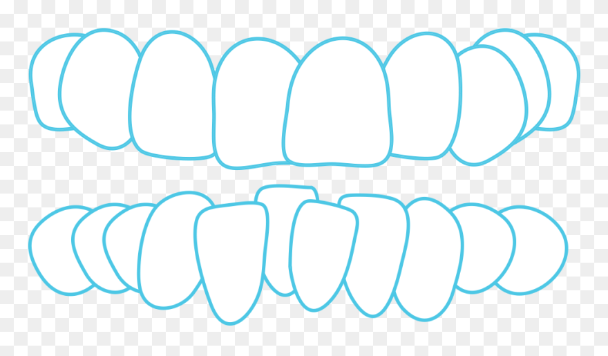 Crowding - Circle Clipart