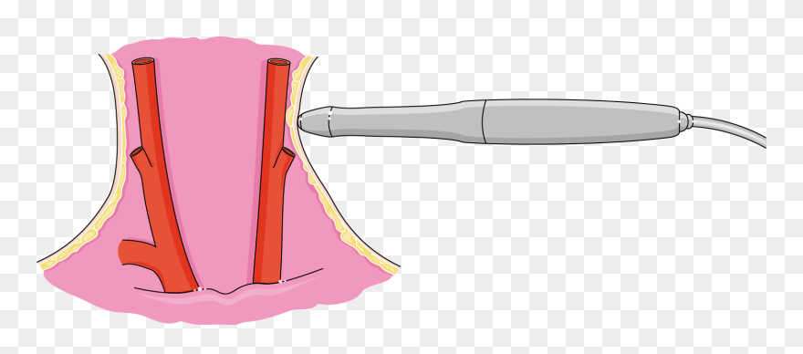 Drawing Clipart