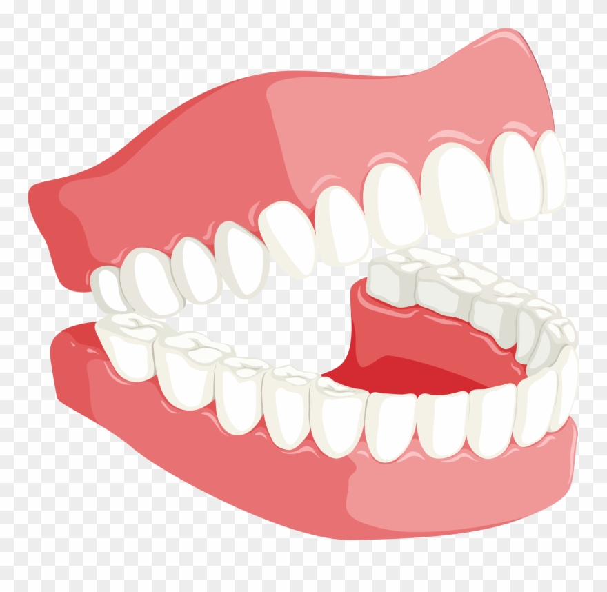 Angeles For A Treatment - Dentistry Clipart