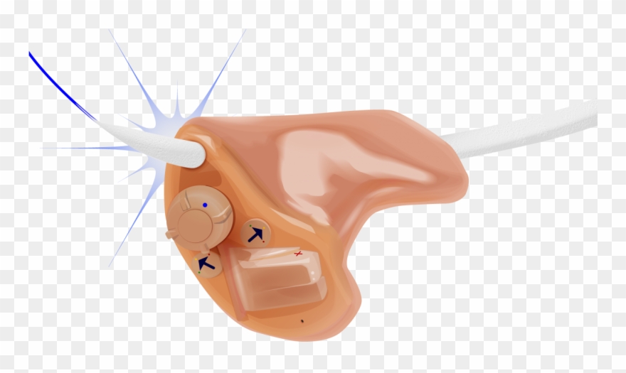 Clear Sound Hearing Aid Cleaner - Clear Sound Hearing Aid Clipart